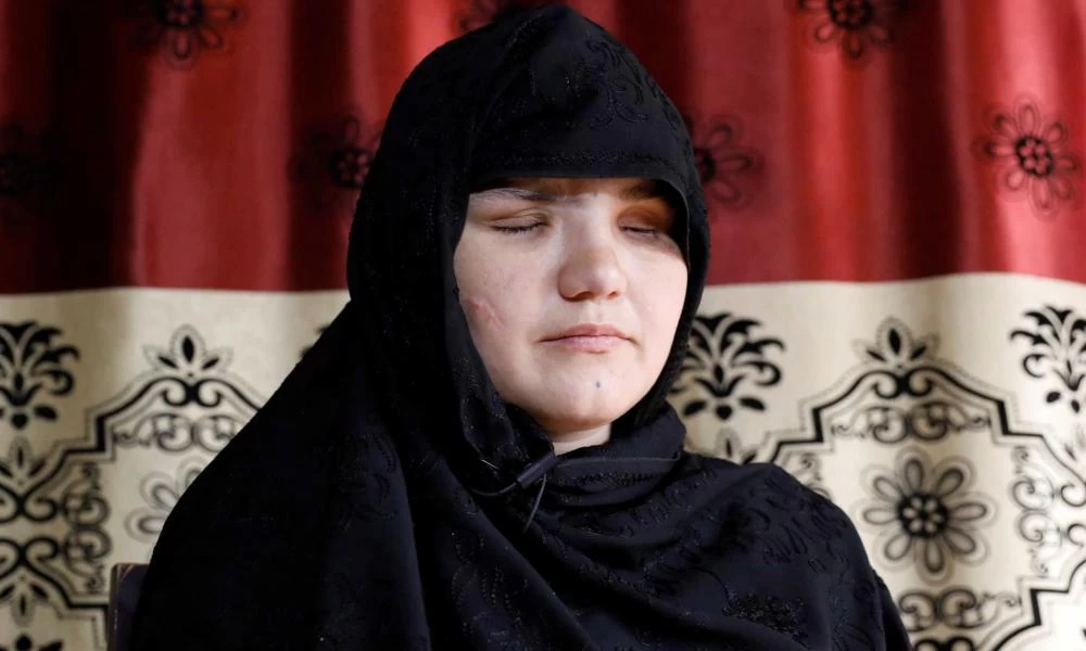 Αφγανιστάν: Τύφλωσαν 33χρονη επειδή έπιασε δουλειά!